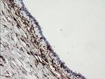 F13A1 Antibody in Immunohistochemistry (Paraffin) (IHC (P))