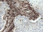 F13A1 Antibody in Immunohistochemistry (Paraffin) (IHC (P))