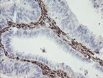 F13A1 Antibody in Immunohistochemistry (Paraffin) (IHC (P))