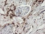 F13A1 Antibody in Immunohistochemistry (Paraffin) (IHC (P))