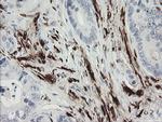 F13A1 Antibody in Immunohistochemistry (Paraffin) (IHC (P))