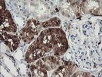 F13A1 Antibody in Immunohistochemistry (Paraffin) (IHC (P))