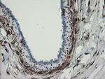 F13A1 Antibody in Immunohistochemistry (Paraffin) (IHC (P))