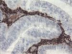 F13A1 Antibody in Immunohistochemistry (Paraffin) (IHC (P))