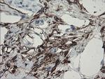 F13A1 Antibody in Immunohistochemistry (Paraffin) (IHC (P))