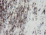 F13A1 Antibody in Immunohistochemistry (Paraffin) (IHC (P))