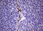 F13A1 Antibody in Immunohistochemistry (Paraffin) (IHC (P))