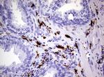 F13A1 Antibody in Immunohistochemistry (Paraffin) (IHC (P))