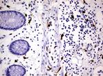 F13A1 Antibody in Immunohistochemistry (Paraffin) (IHC (P))
