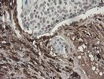 F13A1 Antibody in Immunohistochemistry (Paraffin) (IHC (P))