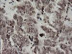 F13A1 Antibody in Immunohistochemistry (Paraffin) (IHC (P))