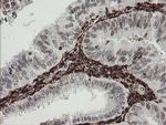 F13A1 Antibody in Immunohistochemistry (Paraffin) (IHC (P))
