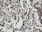 F13A1 Antibody in Immunohistochemistry (Paraffin) (IHC (P))