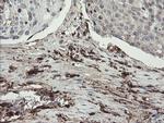 F13A1 Antibody in Immunohistochemistry (Paraffin) (IHC (P))
