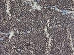 F13A1 Antibody in Immunohistochemistry (Paraffin) (IHC (P))