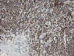F13A1 Antibody in Immunohistochemistry (Paraffin) (IHC (P))