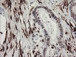 F13A1 Antibody in Immunohistochemistry (Paraffin) (IHC (P))