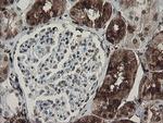 F13A1 Antibody in Immunohistochemistry (Paraffin) (IHC (P))