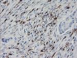F13A1 Antibody in Immunohistochemistry (Paraffin) (IHC (P))