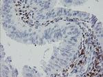 F13A1 Antibody in Immunohistochemistry (Paraffin) (IHC (P))