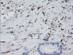 F13A1 Antibody in Immunohistochemistry (Paraffin) (IHC (P))