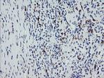 F13A1 Antibody in Immunohistochemistry (Paraffin) (IHC (P))