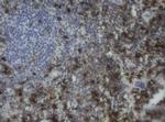 F13A1 Antibody in Immunohistochemistry (Paraffin) (IHC (P))