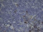 F13A1 Antibody in Immunohistochemistry (Paraffin) (IHC (P))