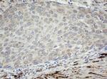 F13A1 Antibody in Immunohistochemistry (Paraffin) (IHC (P))