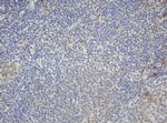 F13A1 Antibody in Immunohistochemistry (Paraffin) (IHC (P))