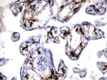 F13A1 Antibody in Immunohistochemistry (Paraffin) (IHC (P))