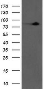F13A1 Antibody in Western Blot (WB)