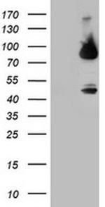 F13A1 Antibody in Western Blot (WB)