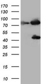 F13A1 Antibody in Western Blot (WB)