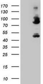 F13A1 Antibody in Western Blot (WB)