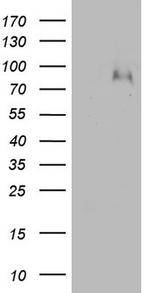 F13B Antibody in Western Blot (WB)