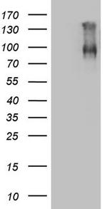 F13B Antibody in Western Blot (WB)
