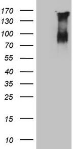 F13B Antibody in Western Blot (WB)
