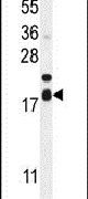 FAM162A Antibody in Western Blot (WB)