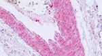 PAR2 Antibody in Immunohistochemistry (Paraffin) (IHC (P))