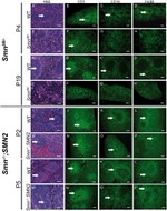 F4/80 Antibody in Immunohistochemistry (IHC)
