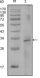 Factor VIII Monoclonal Antibody (5E9B2)