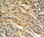 FAM91A1 Antibody in Immunohistochemistry (IHC)