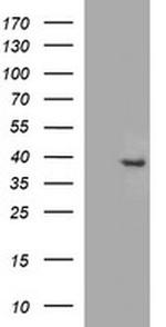 FA2H Antibody in Western Blot (WB)