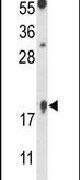 FAM96B Antibody in Western Blot (WB)