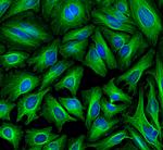 Rabbit IgG (H+L) Cross-Adsorbed Secondary Antibody in Immunocytochemistry (ICC/IF)