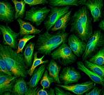 Rabbit IgG (H+L) Cross-Adsorbed Secondary Antibody in Immunocytochemistry (ICC/IF)