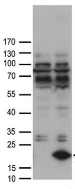 FABP12 Antibody in Western Blot (WB)