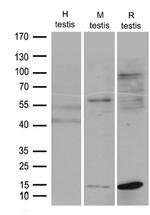 FABP12 Antibody in Western Blot (WB)