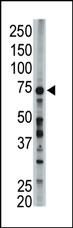 ACSL6 Antibody in Western Blot (WB)